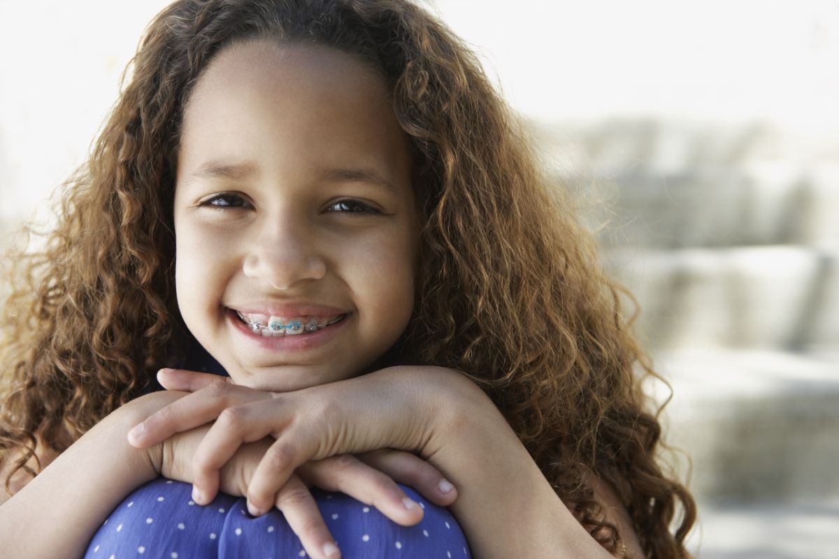 How Do Braces Straighten Teeth?