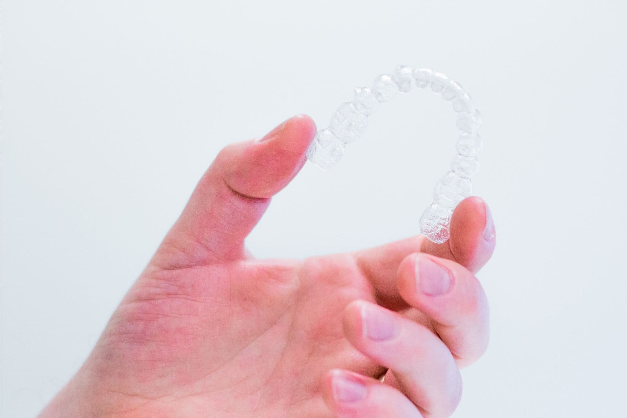 Clear Aligners for Teens: What Every Parent Should Know Before Treatment